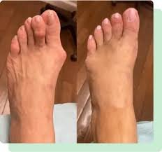 Plantar Fasciitis Doctor In South Amboy